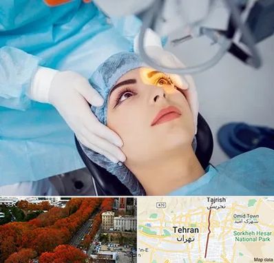 دکتر عمل لیزیک چشم در ولیعصر