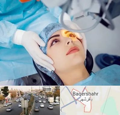 دکتر عمل لیزیک چشم در باقرشهر