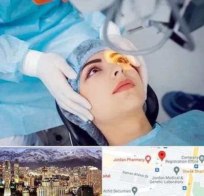 دکتر عمل لیزیک چشم در جردن