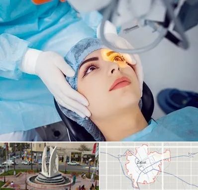 دکتر عمل لیزیک چشم در زابل
