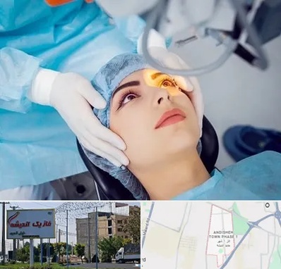 دکتر عمل لیزیک چشم در فاز یک اندیشه