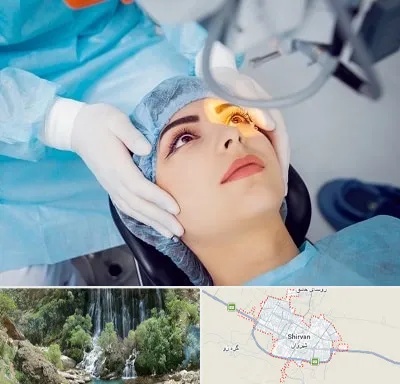 دکتر عمل لیزیک چشم در شیروان