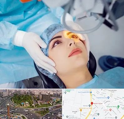 دکتر عمل لیزیک چشم در سبلان