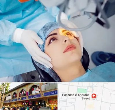دکتر عمل لیزیک چشم در 15 خرداد