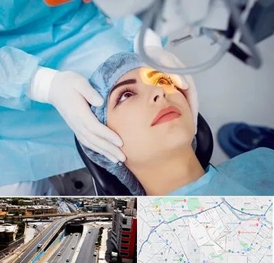 دکتر عمل لیزیک چشم در ستارخان شیراز