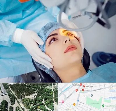 دکتر عمل لیزیک چشم در سالاریه قم