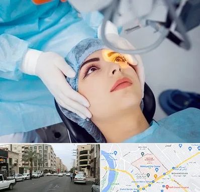 دکتر عمل لیزیک چشم در زیتون کارمندی اهواز