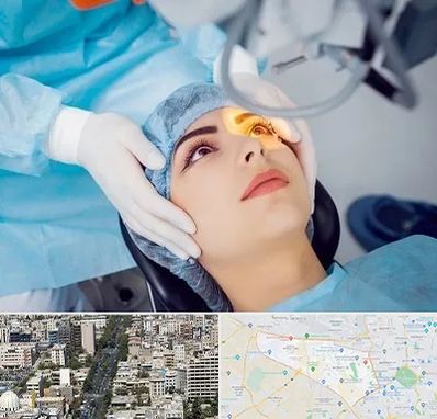 دکتر عمل لیزیک چشم در منطقه 18 تهران