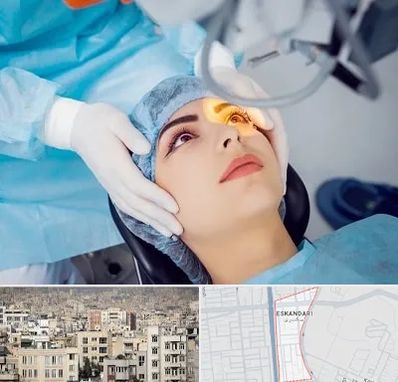 دکتر عمل لیزیک چشم در اسکندری