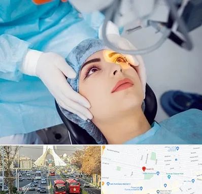 دکتر عمل لیزیک چشم در خیابان آزادی
