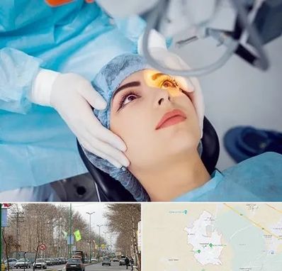 دکتر عمل لیزیک چشم در نظرآباد کرج