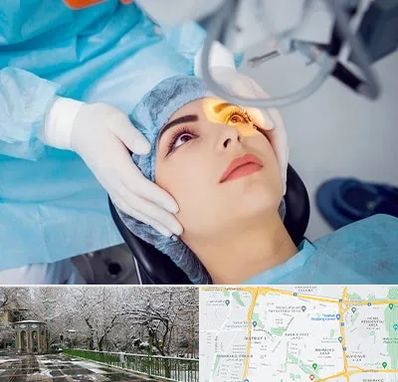 دکتر عمل لیزیک چشم در باغ فیض