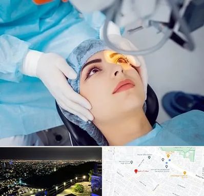 دکتر عمل لیزیک چشم در هفت تیر مشهد