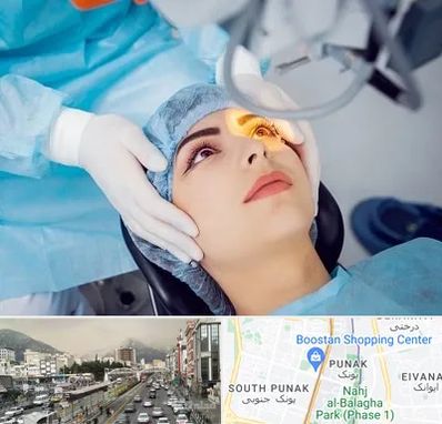 دکتر عمل لیزیک چشم در پونک