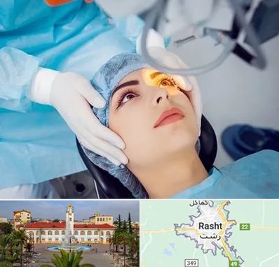دکتر عمل لیزیک چشم در رشت