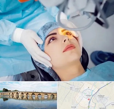 دکتر عمل لیزیک چشم در فلاورجان