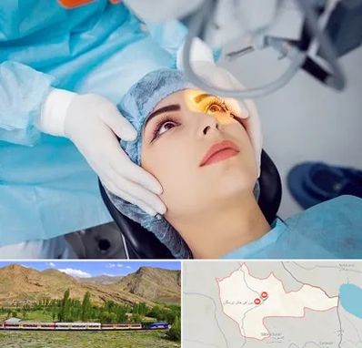 دکتر عمل لیزیک چشم در خاش