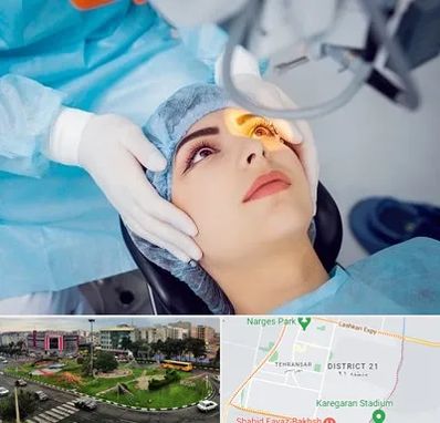 دکتر عمل لیزیک چشم در تهرانسر