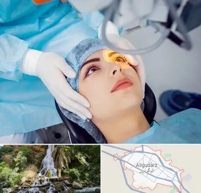 دکتر عمل لیزیک چشم در الیگودرز