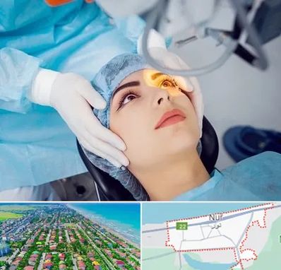 دکتر عمل لیزیک چشم در نور