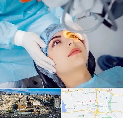 دکتر عمل لیزیک چشم در شهرک راه آهن