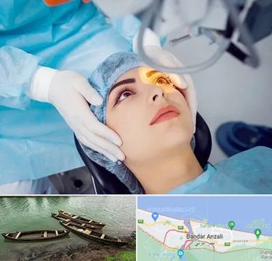 دکتر عمل لیزیک چشم در بندر انزلی