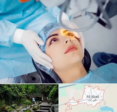 دکتر عمل لیزیک چشم در علی‌ آباد کتول