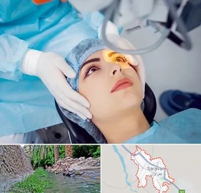 دکتر عمل لیزیک چشم در سراوان