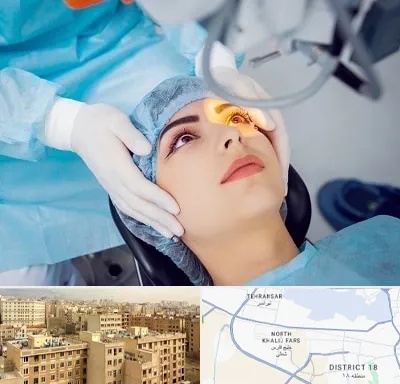 دکتر عمل لیزیک چشم در جنوب غرب تهران