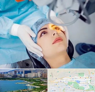 دکتر عمل لیزیک چشم در منطقه 22 تهران