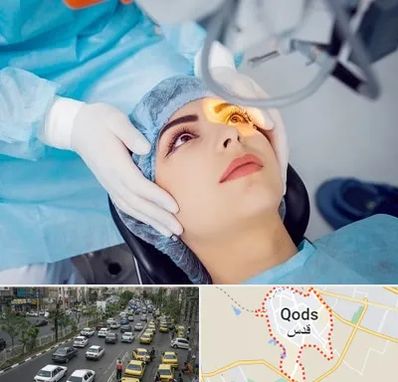 دکتر عمل لیزیک چشم در شهر قدس