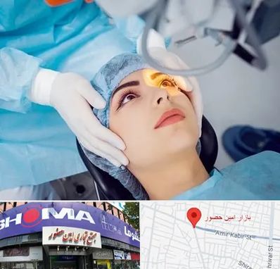 دکتر عمل لیزیک چشم در امین حضور