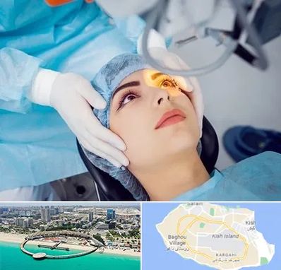 دکتر عمل لیزیک چشم در کیش