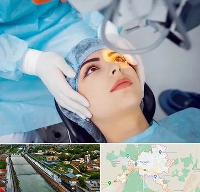 دکتر عمل لیزیک چشم در مراغه