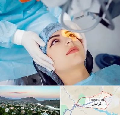 دکتر عمل لیزیک چشم در لواسان