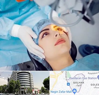 دکتر عمل لیزیک چشم در قلهک