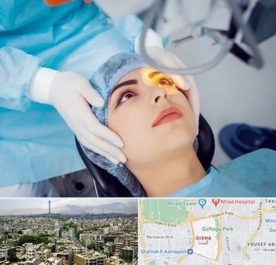 دکتر عمل لیزیک چشم در گیشا