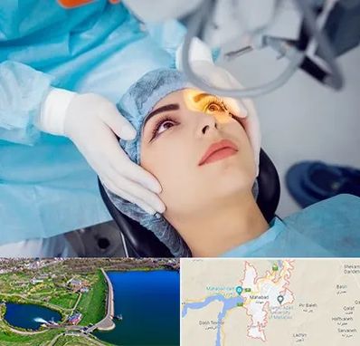 دکتر عمل لیزیک چشم در مهاباد