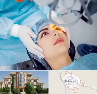 دکتر عمل لیزیک چشم در دهدشت