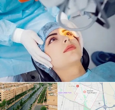 دکتر عمل لیزیک چشم در فاز سه اندیشه