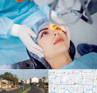 دکتر عمل لیزیک چشم در ضیابری رشت