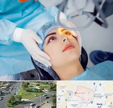 دکتر عمل لیزیک چشم در شاهین ویلا کرج