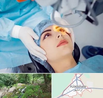 دکتر عمل لیزیک چشم در آزادشهر