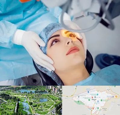 دکتر عمل لیزیک چشم در بجنورد