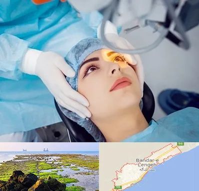 دکتر عمل لیزیک چشم در بندرلنگه