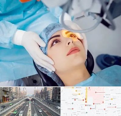 دکتر عمل لیزیک چشم در توحید