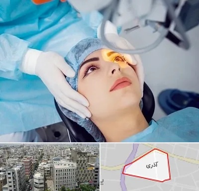 دکتر عمل لیزیک چشم در آذری