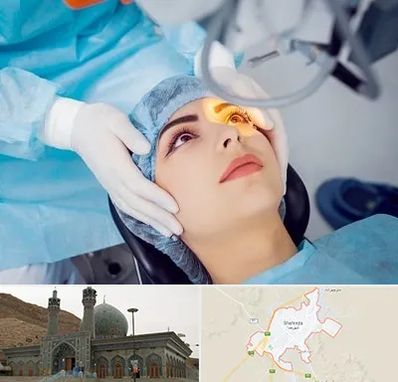 دکتر عمل لیزیک چشم در شهرضا