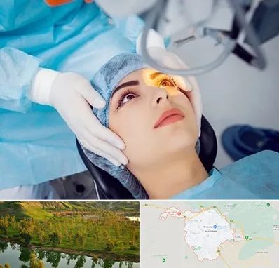 دکتر عمل لیزیک چشم در بهبهان