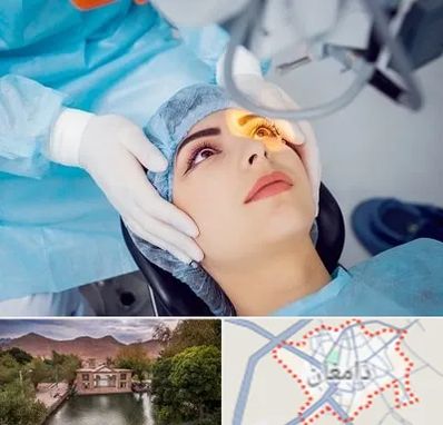 دکتر عمل لیزیک چشم در دامغان